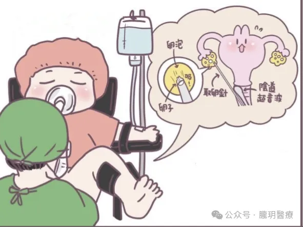 取卵痛嗎？無痛取卵對試管有影響嗎？