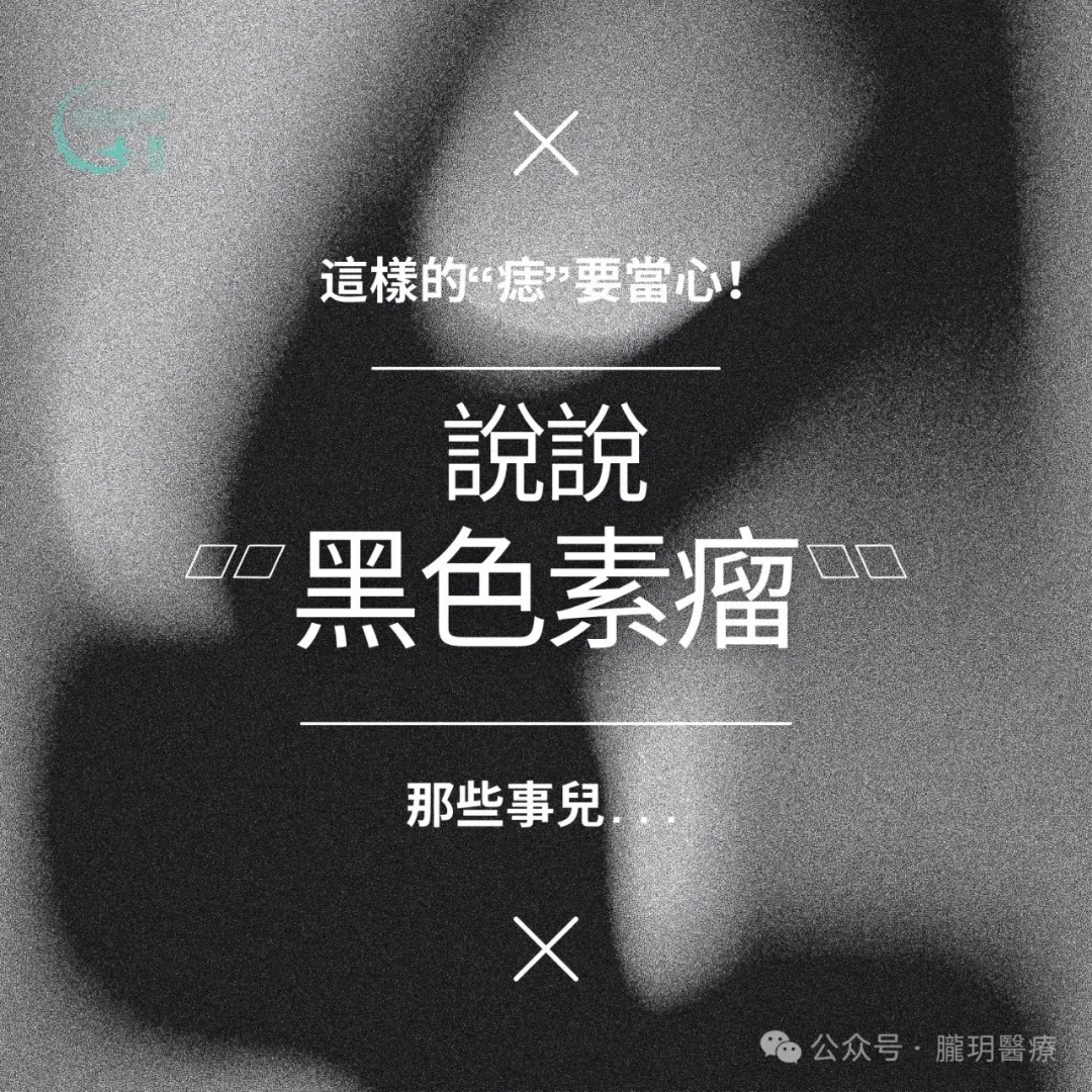 這樣的“痣”要當心！說說“黑色素瘤”那些事兒……